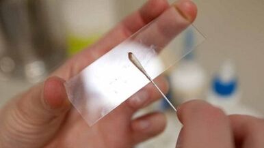 Calais analýza pro identifikaci parazitů