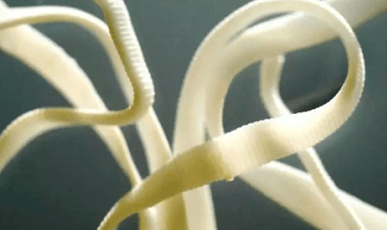 Jak odstranit parazity z lidského těla