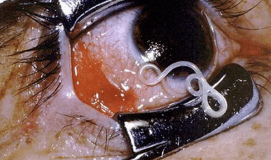 Typy parazitů v lidském těle